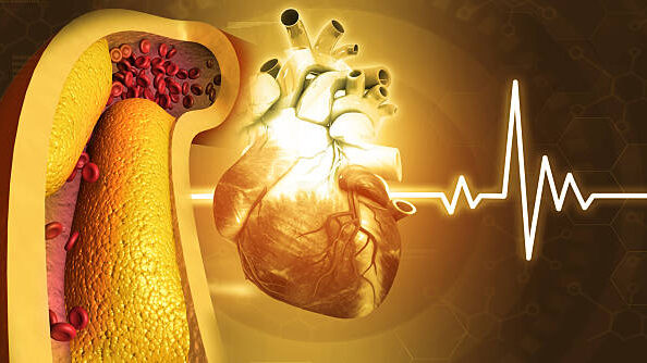 8 Reason Being Slim Doesn't Mean Safe Cholesterol