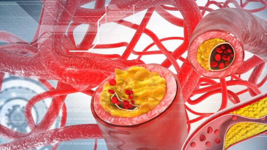 8 Silent High Cholesterol Risk Factors You Can Still Reverse