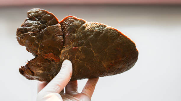 Detox Warning: 7 Liver Cleanse Myths That Just Don't Hold Up