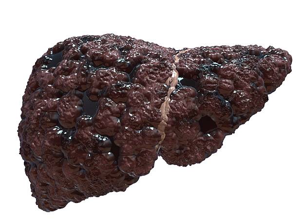 Liver Health: 8 Small Changes That Make a Genuinely Big Difference