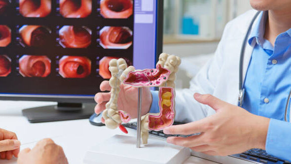 Gut Health: 8 Facts Most People Discover Way Too Late
